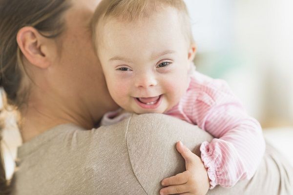 چطور به کودکی با سندرم داون شیر بدهید