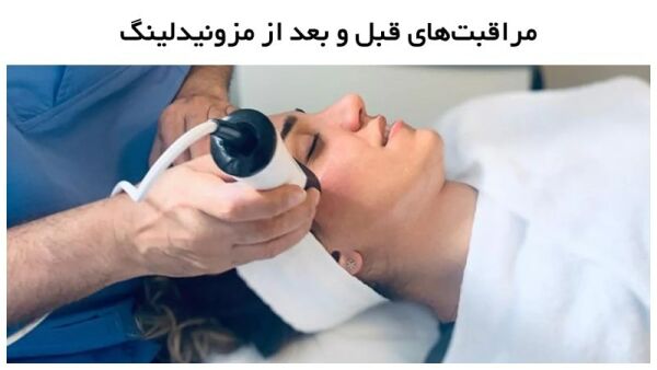 مراقبت‌های بعد از مزونیدلینگ