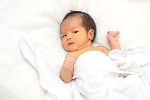 عوارض تعویض خون نوزاد به علت زردی