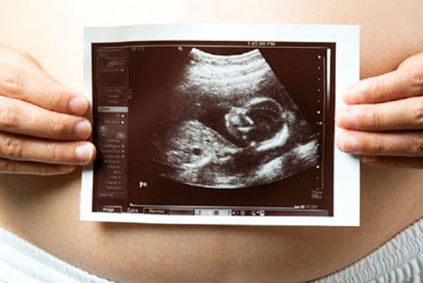 سونوگرافی ضروری بارداری