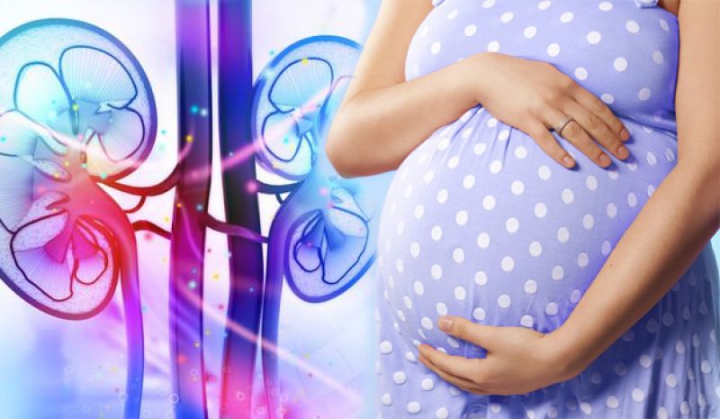 سنگ کلیه و اقدام برای بارداری