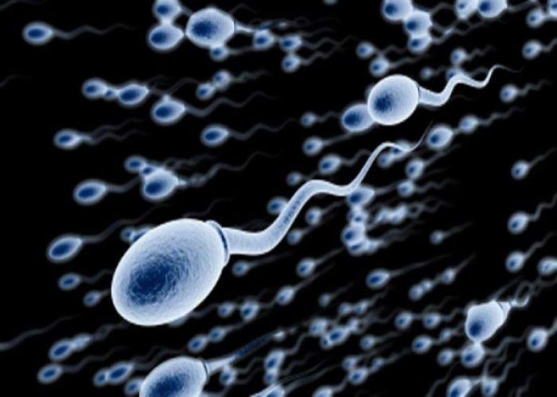 علل کم تحرکی اسپرم ها