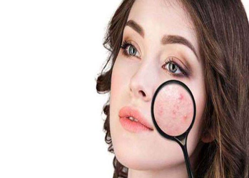 علت جوش زدن در بارداری چیست؟