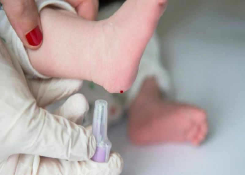 آزمایش کف پای نوزاد برای چیست؟
