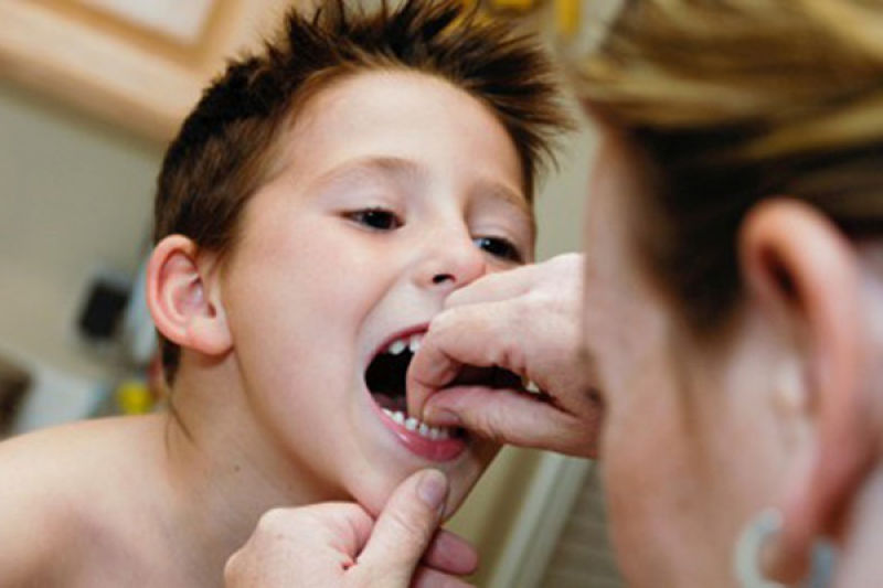 کشیدن دندان ششم کودکان