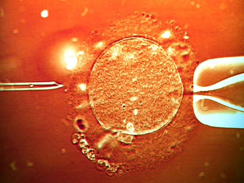مورفولوژی اسپرم و IVF