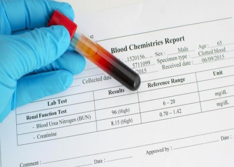 از چه وقت آزمایش خون بارداری را نشان می‌دهد؟