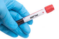 بررسی سلامت کبد با آزمایش SGOT